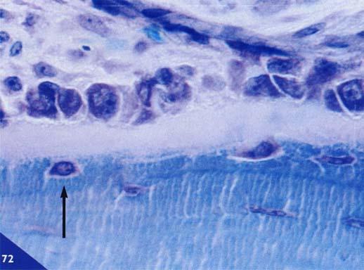 Questa cellula è completamente localizzato all'interno dell orletto osteoide, ma con l estremità osteogenica vascolare della membrana plasmatica ancora in contatto con la lamina.