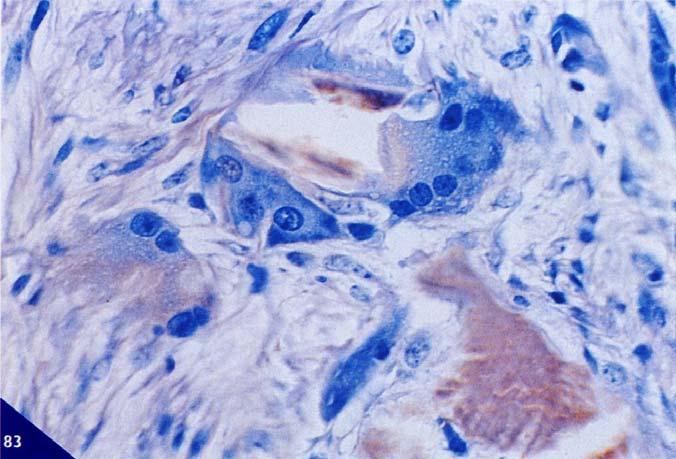 OSTEOCLASTI Gli osteoclasti sono le cellule deputate alla degradazione e riassorbimento della matrice ossea e hanno notevoli dimensioni, circa 100 µm.