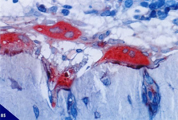 Il sistema di connessione intracellulare si realizza nella zona centrale dei podosomi per mezzo di un complesso proteico, costituito da α-actina, fimbrina e gelsolina (Marchisio et al 1984, 1987),