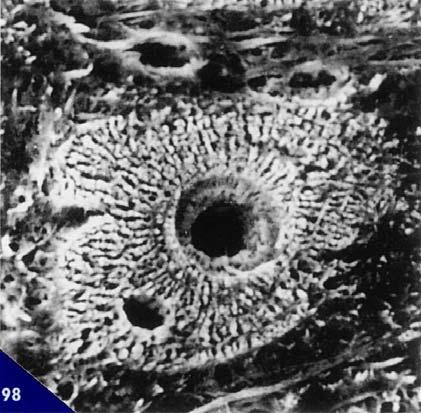 Nell uomo la varietà strutturale maggiormente rappresentata nella costituzione dell osso primario o di addizione è quella dell osso a fibre intrecciate; in percentuale decrescente, segue l osso