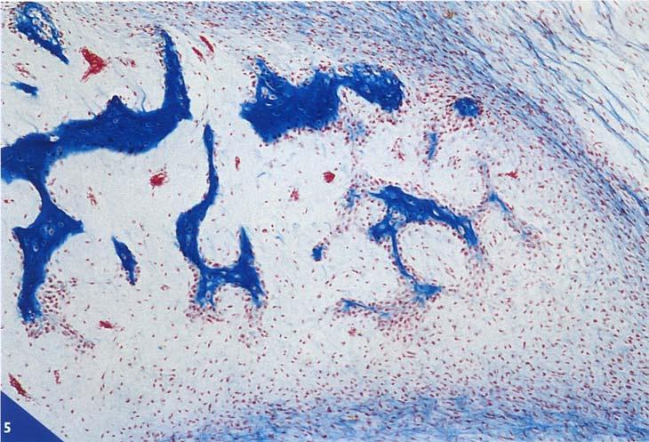 OSSIFICAZIONE INTRAMEMBRANOSA Alcune ossa piatte del cranio, come il frontale, il parietale, l'occipitale, il temporale e parte della mandibola, si formano per ossificazione intramembranosa (Fig.