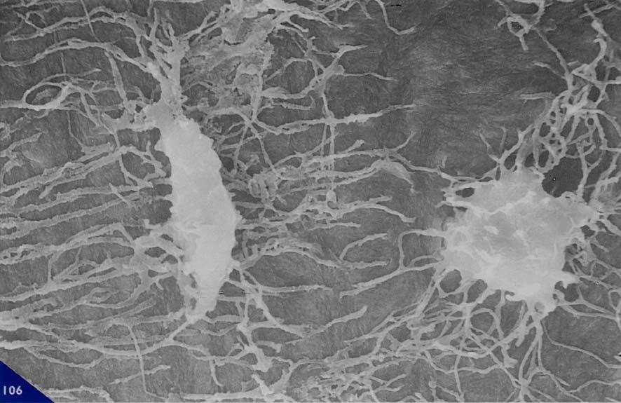 canalicolare priva di un preciso orientamento nell arborizzazione. Femore (Homo). 106. Osteociti di osso neoformato, a ridosso in una protesi in TiAlV.