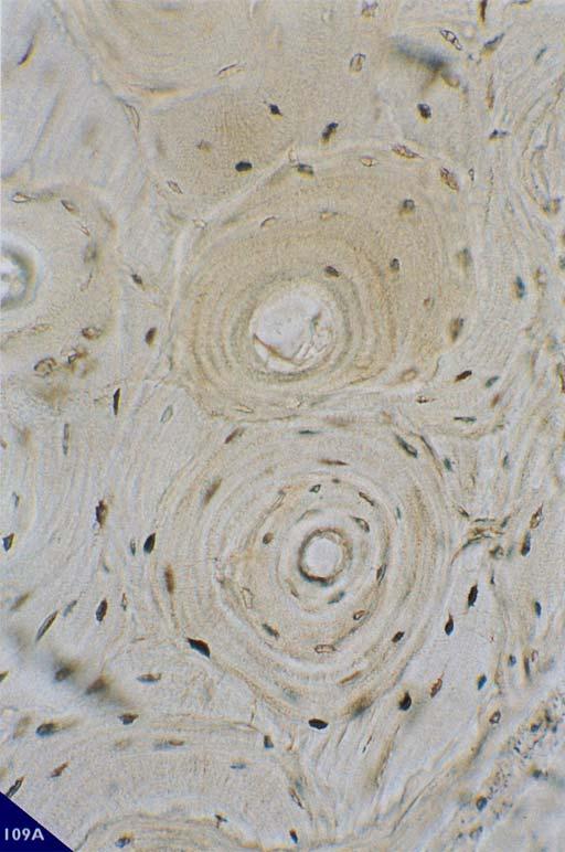 OSS0 LAMELLARE L osso lamellare è il tessuto maggiormente presente nello scheletro dell individuo adulto. La matrice è organizzata in strati laminari regolari definiti lamelle ossee.