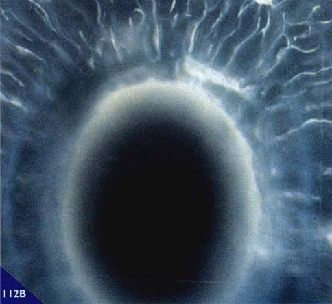 Osteociti di osso lamellare al microscopio ottico a luce ordinaria (A) e a luce polarizzata (B).