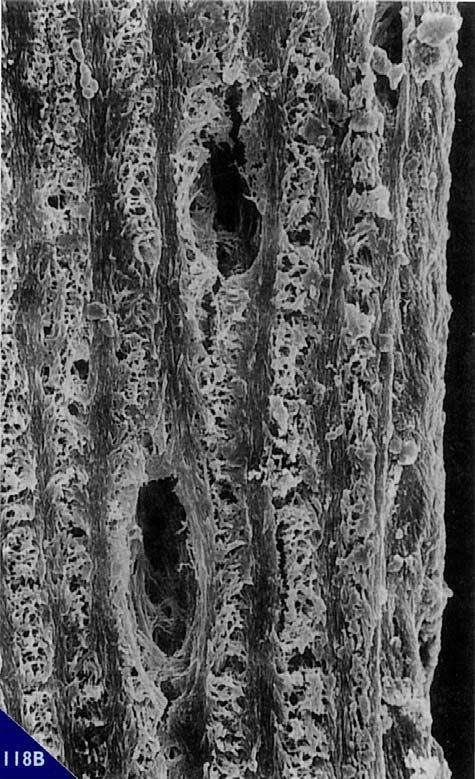 arborizzazione dendritica, con processi citoplasmatici rivolti verso il territorio vascolare notevolmente più lunghi rispetto a quelli rivolti in direzione opposta.