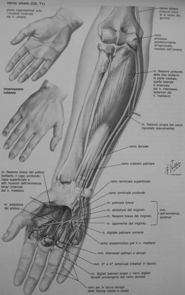 sindrome del tunnel ulnare