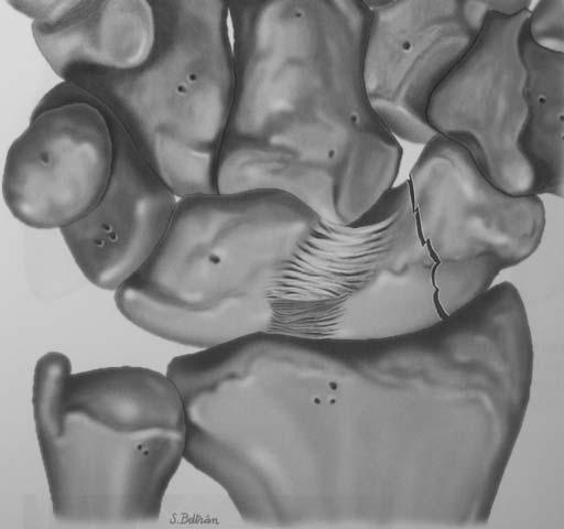 traumatologia traumatologia la