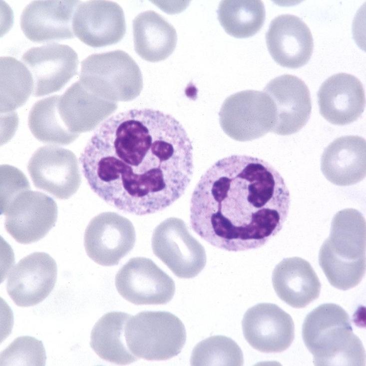 GRANULOCITI NEUTROFILI (60-70%) Nucleo polilobato (2-5 lobi) Eterocromatina 12-14 µm Granulazioni citoplasmatiche (lilla) contenenti enzimi