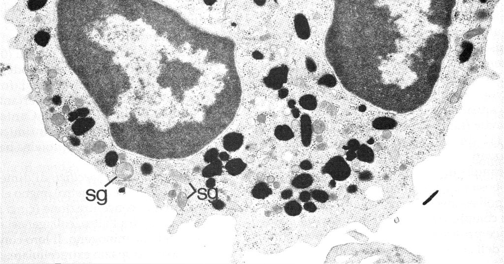 5 µm), lisosomi: - Idrolasi acide -Proteine con azione