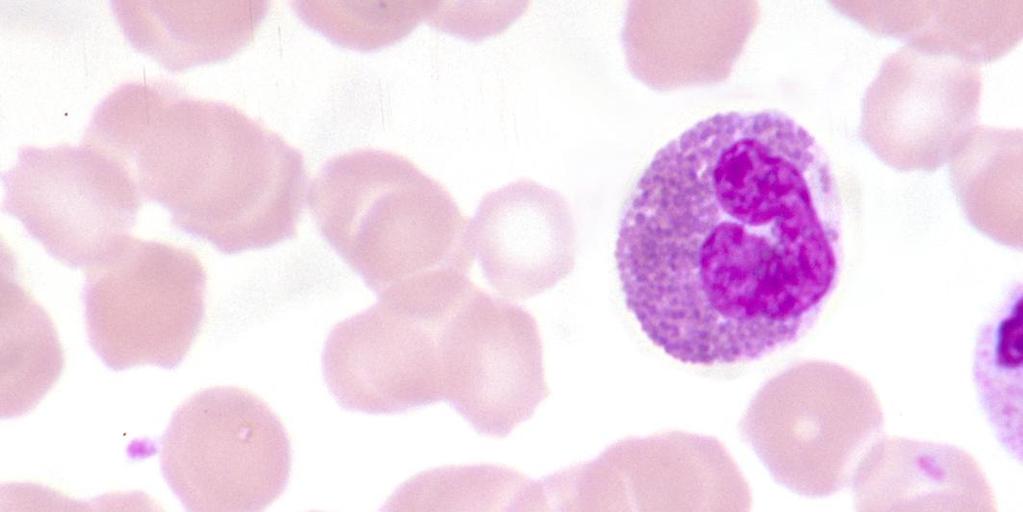 GRANULOCITI EOSINOFILI (1-3%) 10-12 µm Granulazioni