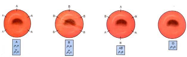 I GRUPPI SANGUIGNI NELL'UOMO Il tipo di gruppo sanguigno nell'uomo è determinato da 3 alleli: A, B, 0, con entrambi gli alleli A e B