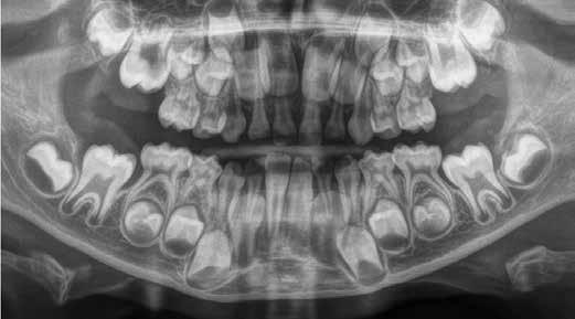 28 I 29 Orthophos XG 5 PRO Grande varietà per risultati perfetti: Orthophos XG 5 è la soluzione per i dentisti generici e per gli ortodonzisti perché, grazie ai diversi programmi, è in grado di