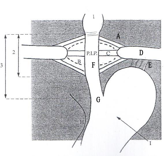 1 - SISTEMA LEGAMENTOSO - Legamento Freno-esofageo (A) - Legamento Gastro-frenico (E) - Muscoli di Rouget e Juvara (C) -