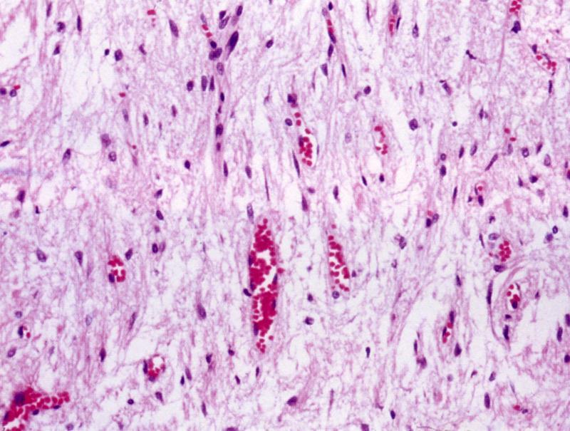 Ipofisi Posteriore Assoni non mielinati delle cellule neurosecretorie OSSITOCINA VASOPRESSINA Corpi cellulari sono nell
