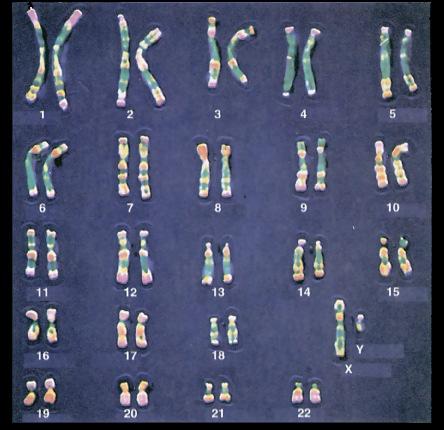IL NUCLEO la cromatina Ogni specie eucariotica ha un numero caratteristico di cromosomi.