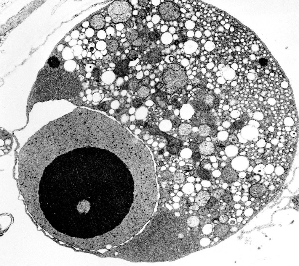 Morfologia apoptosi (TEM): Cromatina Condensata, Corpi apoptotici, evaginazioni della membrana La cromatina