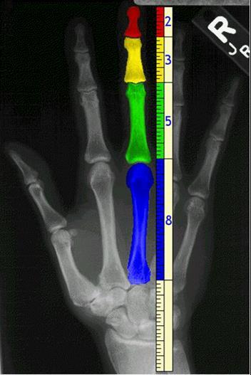 Sezione aurea nel corpo umano Anche nel corpo umano possiamo trovare numerosi rapporti aurei.