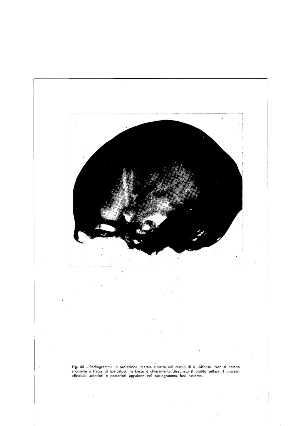 Fig. SO - Radiogramma in proiezione laterale sinistra del cranio di S. Alfonso. Non si notano anomalie o tracce di lpèrostoal.