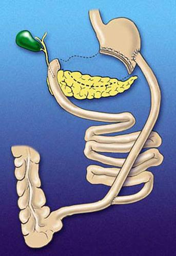 Ghrelin Increase GIP