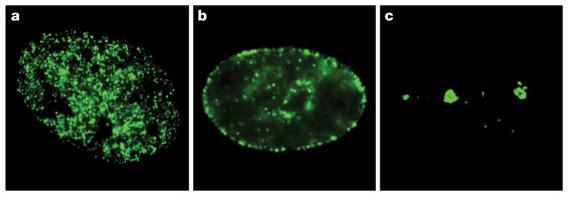 fattore 53BP1 in corrispondenza delle rotture a doppio filamento (danni al DNA) Misteli, Cell 2007 doi:10.