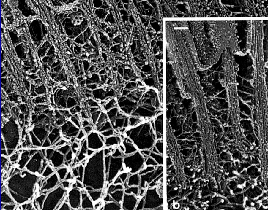 1 µm Contengono filamenti di actina di sostegno Funzione: aumento di