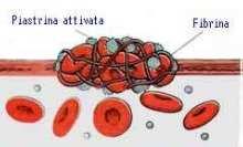 Il processo di guarigione comporta tre fasi che si sovrappongono in modo consecutivo e ridondante : 1) Infiammazione 2) proliferazione 3) rimodellamento Fuoriuscita del sangue nel sito di lesione, le