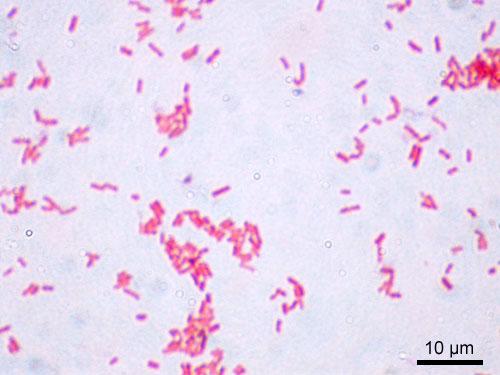 Carta d identità Gram negativo, piccolo (0,4 x 2 µm), mobile, metabolismo fermentativo e ossidativo, ossidasi