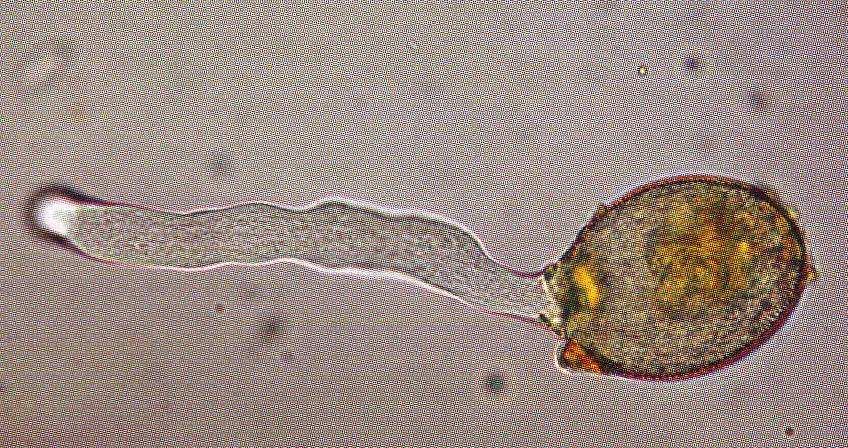 microgametofito nuclei spermatici sacco embrionale o macrogametofito
