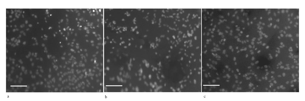 Figura 9: Densità cellulare sui compositi a 24 ore. Colorazione dei nuclei mediante Hoechst 33258. a) nf-cpc; b) 15G; c) 20S/5G (barra = 50 µm, immagini rappresentative).