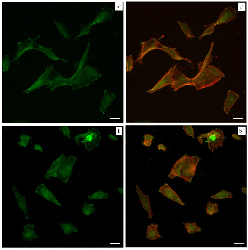 Figura 22: Espressione della vinculina in MG63 seminate su Permanox a 6 ore. a-a ) cellule non trattate. b-b ) cellule trattate con ialuronidasi. a, b.