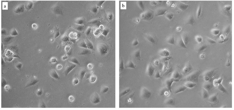 Figura 23: MG63 seminate su fibronectina a un ora. a) cellule non trattate, b) cellule trattate con ialuronidasi.
