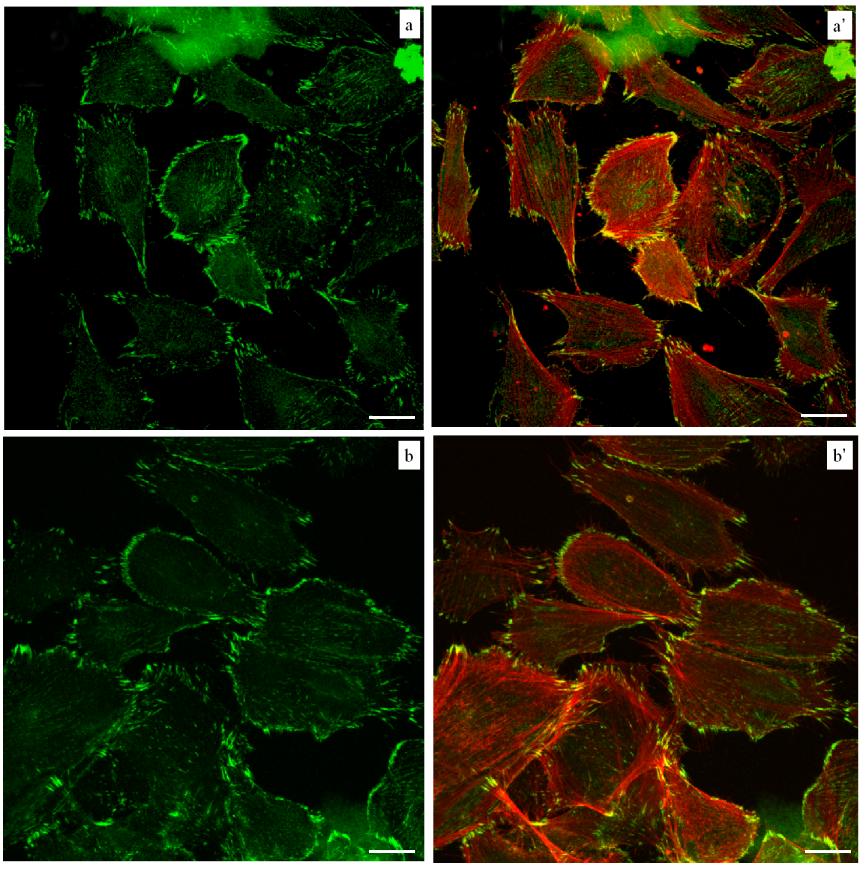 Figura 27: Espressione della vinculina in MG63 seminate su fibronectina a 6 ore. a- a ) cellule non trattate. b-b ) cellule trattate con ialuronidasi. a, b.