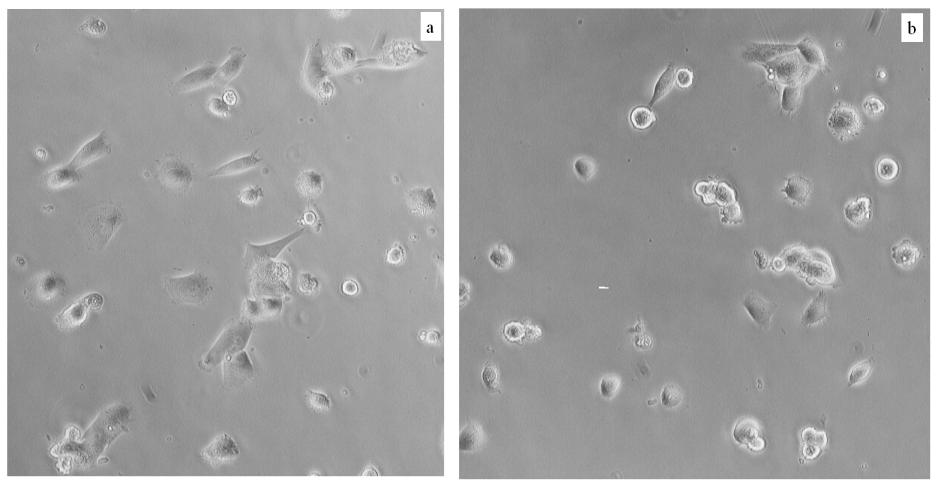 Figura 28: MG63 seminate su collagene I a un ora. a) cellule non trattate, b) cellule trattate con ialuronidasi.