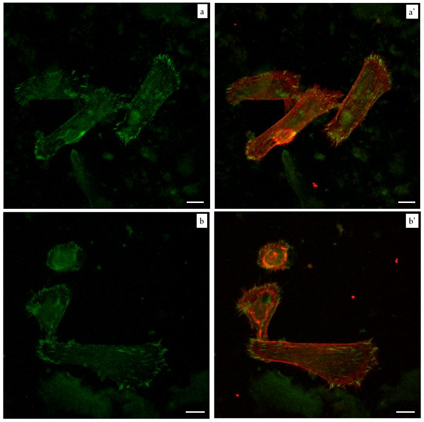 Figura 32: Espressione della vinculina in MG63 seminate su collagene a 6 ore. a-a ) cellule non trattate. b-b ) cellule trattate con ialuronidasi. a, b.