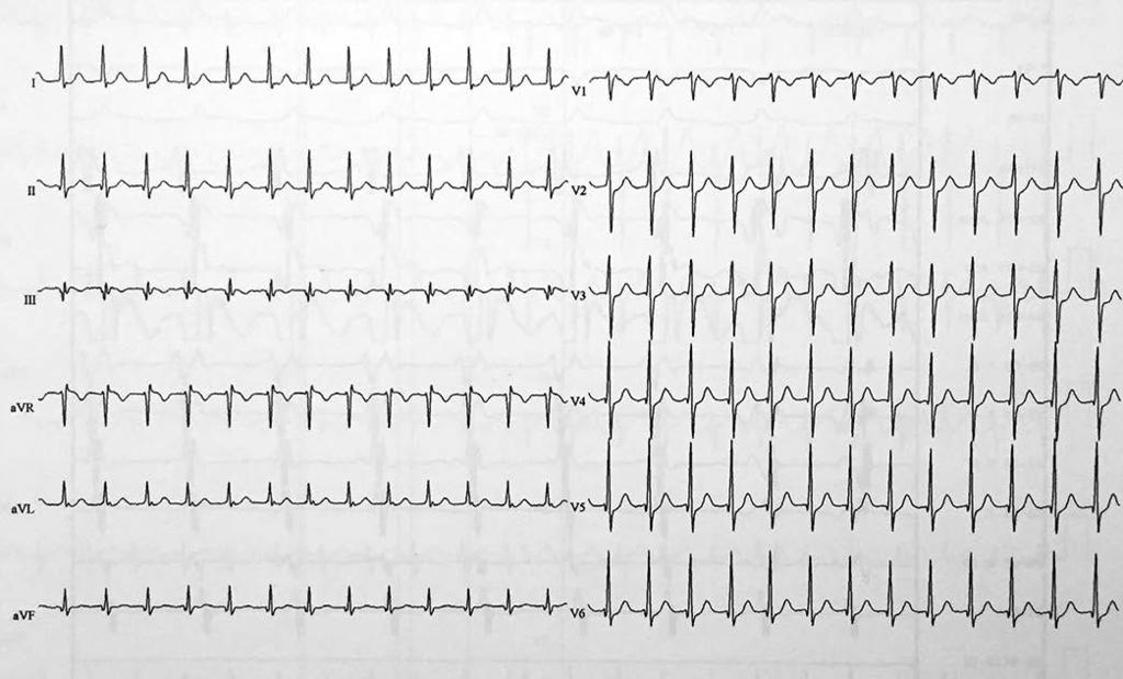 Quaderni acp www.quaderniacp.it 5 [2017] FAD 197 Schema 1. Tracciato tipico per TRNAV.