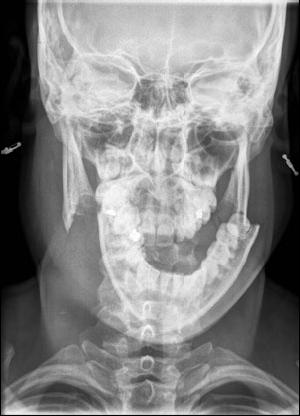 Radiodiagnostica, Medicina Nucleare e Radioterapia.