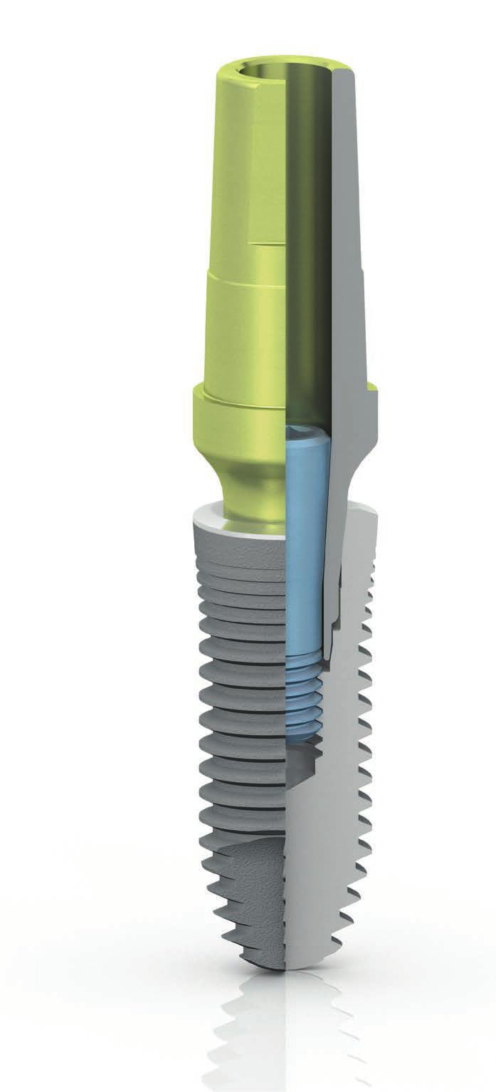 SISTEMA IMPLANTOLOGICO Connessione DAT (Double Action Tight) La connessione DAT (Double Action Tight) rappresenta la caratteristica più innovativa dell impianto CSR: una doppia