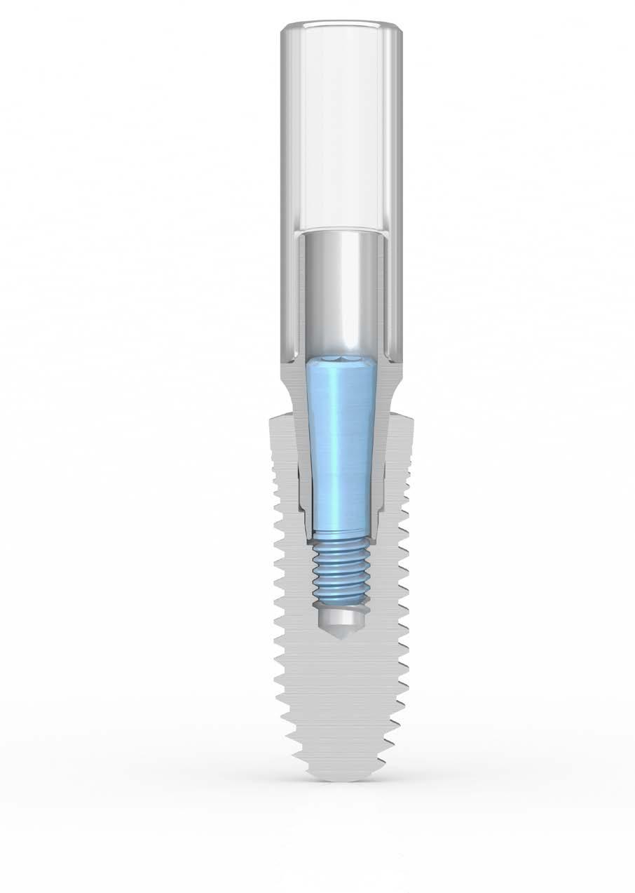 PROTOCOLLI DI UTILIZZO Riabilitazione definitiva con pilastri calcinabili con base in metallo Sweden & Martina produce diversi tipi di pilastri con porzione calcinabile, utili nella realizzazione di