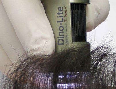 La tricoscopia è una scienza relativamente giovane che studia la salute dei capelli e del cuoio capelluto. Viene spesso praticata dai dermatologi, e sempre più da altri professionisti in campo medico.