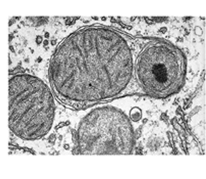 Sono note patologie causate da mutazioni di un singolo