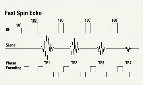 fast spin-echo Nella sequenza fast spin-echo ad ogni echo viene variato il gradiente di fase e quindi i dati raccolti vanno a