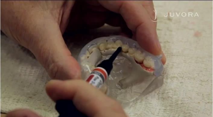 Dentina e massa della gengiva Saldatura dei denti artificiali 1)Applicare la dentina liquida in più fasi tra i denti e la struttura (è necessaria sempre una fotopolimerizzazione intermedia).