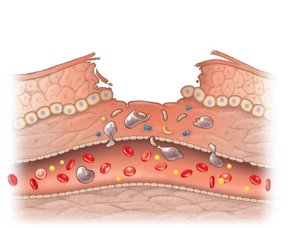 La prima linea di difesa del corpo La risposta infiammatoria Le cellule di un tessuto danneggiato rilasciano delle sostanze chimiche (come l istamina) che attivano la risposta infiammatoria I vasi