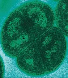 Deinococcus radiodurans: Entra a far parte del guinness world record come organismo in grado di resistere alla maggiore quantità di radiazioni, infatti può resistere a cento volte la dose di