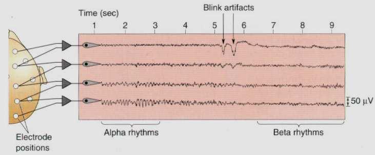 I segnali EEG L aspetto dell attività EEG è dato da onde continue, ritmiche o aritmiche oscillanti, che variano per aspetto, frequenza e ampiezza.