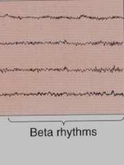 ACTIVITY High-frequency EEG rhythms substitute alpha rhythms during activity Gamma rhythms BRAIN STEM