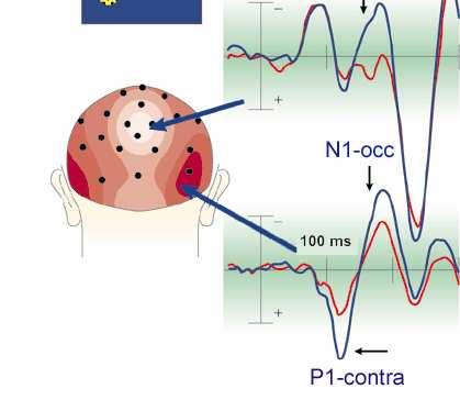 ERP N1: Aumento della componente N1 circa 100 ms dopo la comparsa dello stimolo nella corteccia visiva extrastriata quando lo stimolo è atteso, in confronto a quando non e