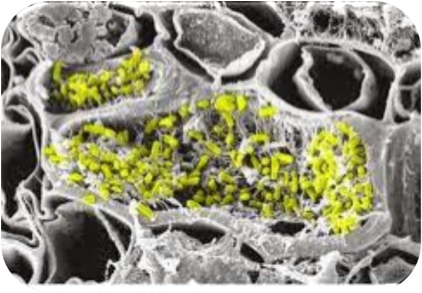 Xylella fastidiosa Scansione al