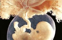 INTERFERENTI TIROIDEI CON ELEVATO POTENZIALE DI ESPOSIZIONE PESTICIDI Etilenbisditiocarbamati - ETU Fungicidi In grado di attraversare la placenta ed escreto nel latte materno La tiroide è uno dei