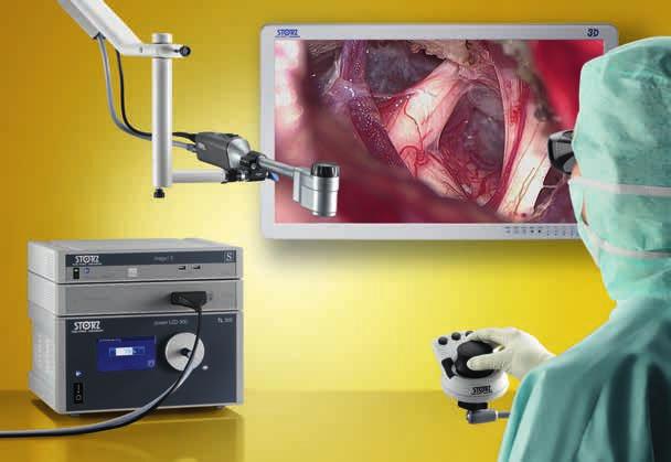 VITOM 3D Visualizzazione 3D per la neurochirurgia Il sistema VITOM 3D rappresenta una soluzione rivoluzionaria per la visualizzazione di interventi microchirurgici e di chirurgia aperta in molte